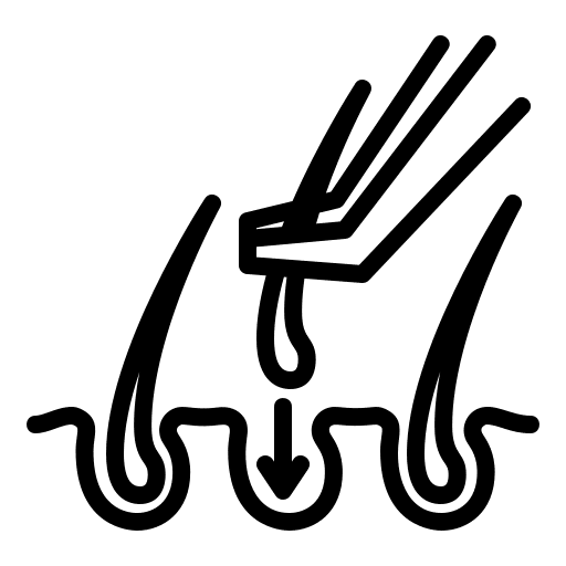 Implantación