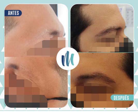 Print